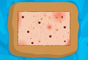 Operate Now: Skin Surgery - Net jogos online - jogos grátis